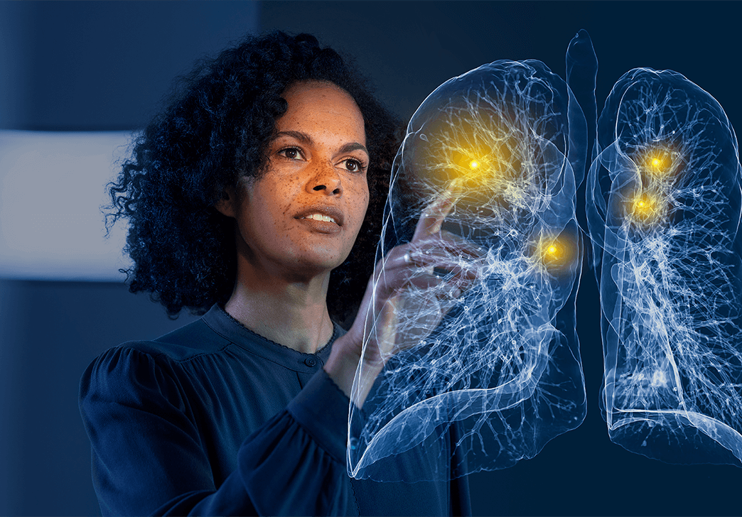 Calantic lungs image